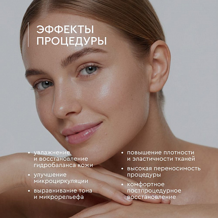 Гион Софт Лайн 1,8% (27 мг), шприц АНГИОФАРМ, 1,5 мл